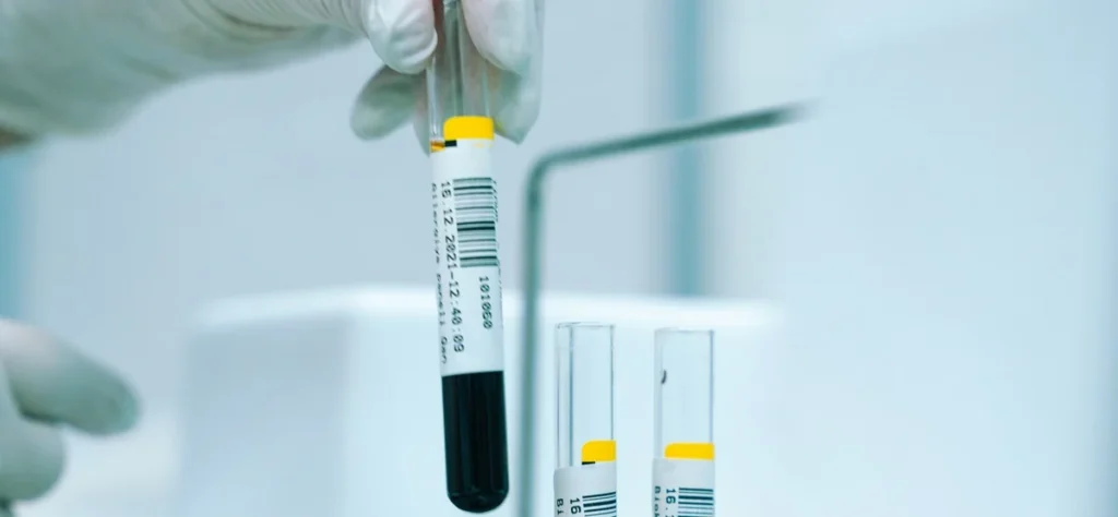 exame de sangue