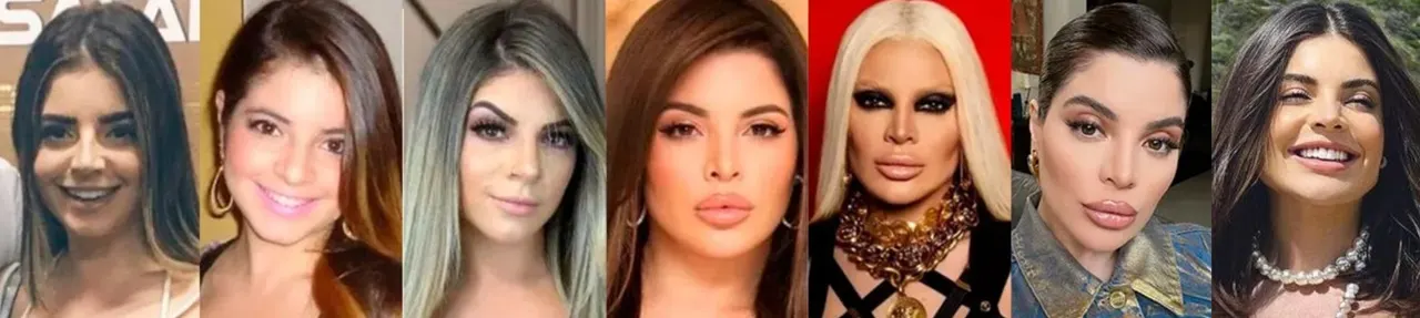 antes e depois GKAY